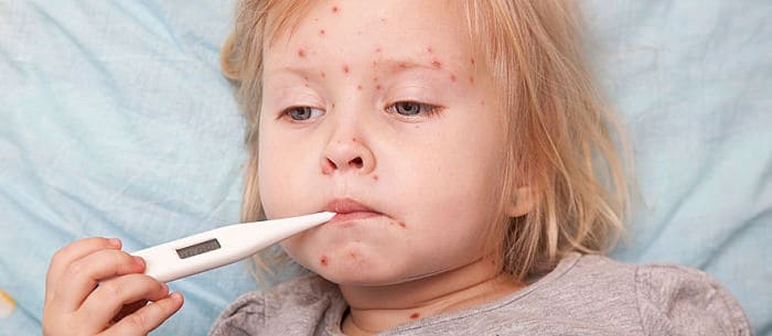 5 Common Baby Rashes