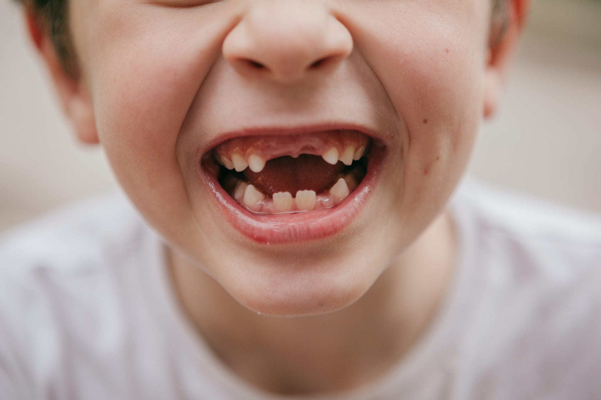 When Do Kids Start Losing Teeth Teeth Chart