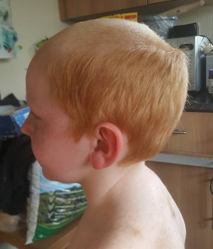 Kid Haircut du Jour: Bald, With a Side of Hair