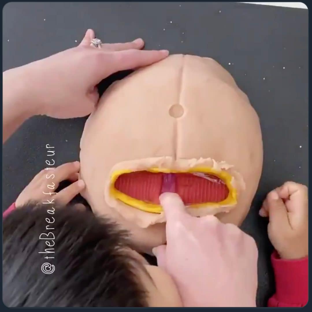 Doctor mom’s creative play dough “C-section” activity is blowing people’s minds