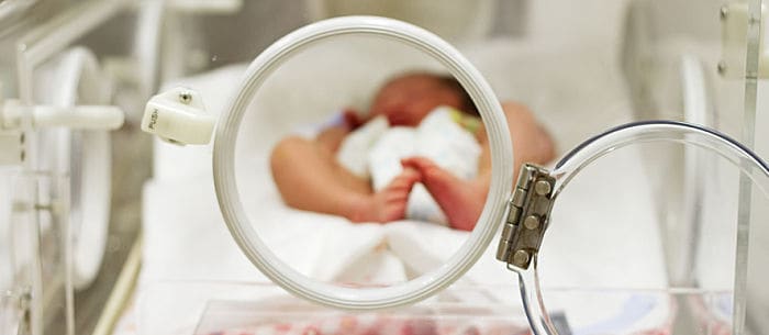 Premature Babies: What To Expect & Prepare