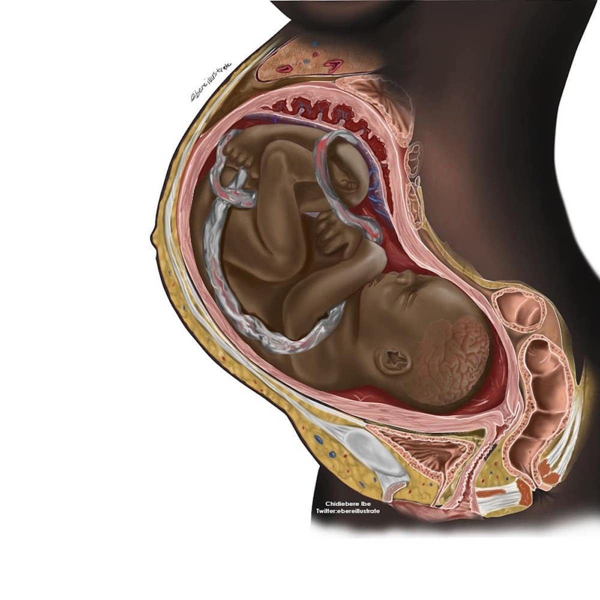 Black medical illustration of pregnancy fuels viral conversation about equity in healthcare